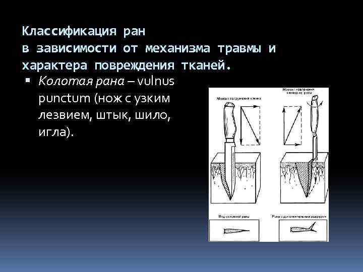 Классификация ран в зависимости от механизма травмы и характера повреждения тканей. Колотая рана –