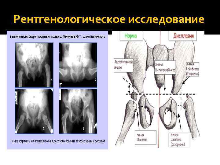 Рентгенологическое исследование 