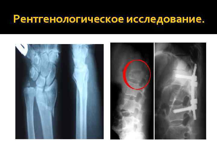Рентгенологическое исследование. 