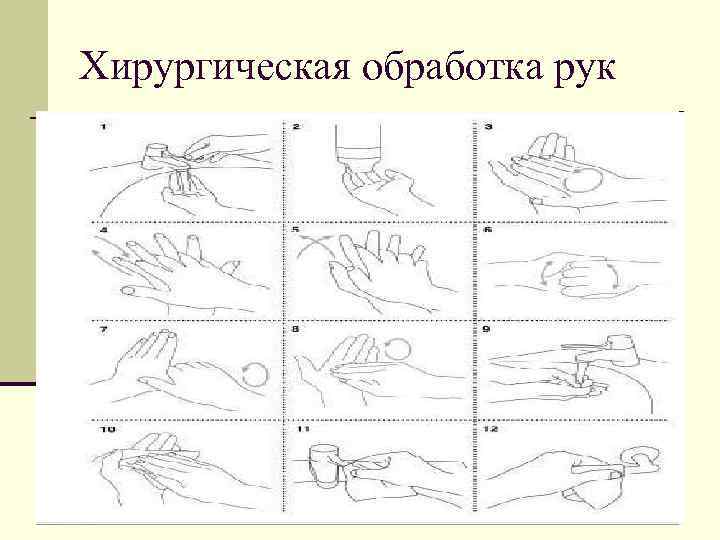 Хирургическая обработка рук. Хирургическое мытье рук алгоритм. Мытье рук хирурга алгоритм. Схема мытья рук хирургическим способом. Хирургический уровень обработки рук.