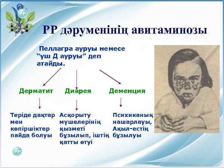 РР дәруменінің авитаминозы Пеллагра ауруы немесе “үш Д ауруы” деп атайды. Дерматит Теріде дақтар