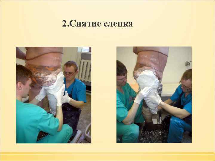  2. Снятие слепка 