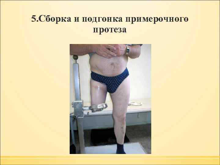 5. Сборка и подгонка примерочного протеза 