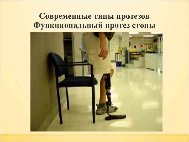 Современные типы протезов Функциональный протез стопы 