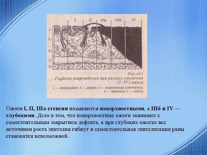 Ожоги I, IIIa степени называются поверхностными, а IIIб и IV — глубокими. Дело в