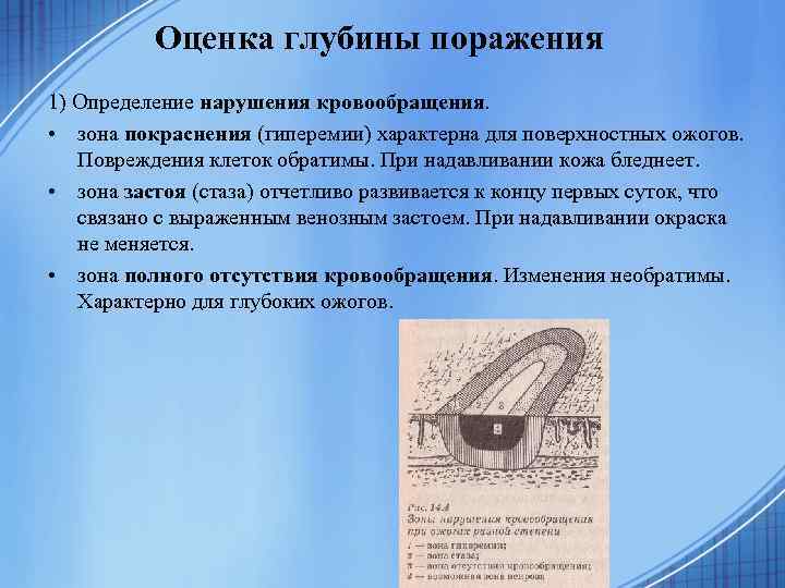 Оценка глубины поражения 1) Определение нарушения кровообращения. • зона покраснения (гиперемии) характерна для поверхностных