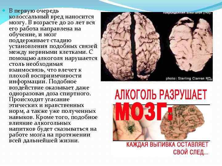  В первую очередь колоссальный вред наносится мозгу. В возрасте до 20 лет вся