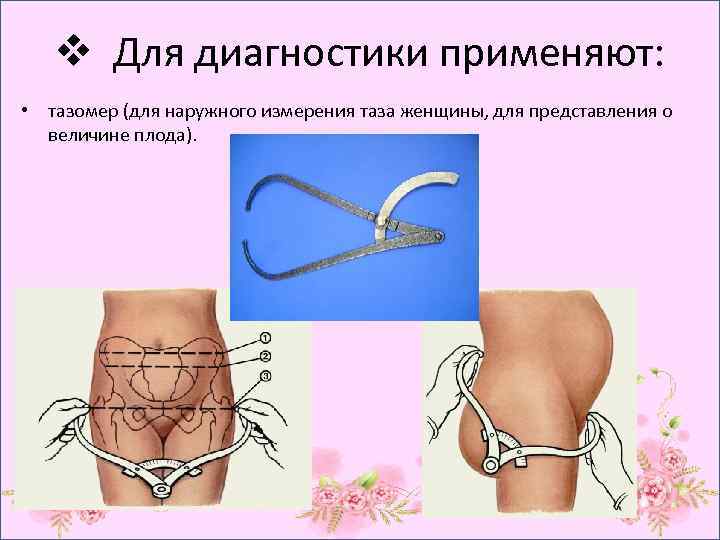 v Для диагностики применяют: • тазомер (для наружного измерения таза женщины, для представления о
