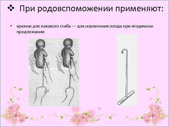 v При родовспоможении применяют: • крючок для пахового сгиба — для извлечения плода при