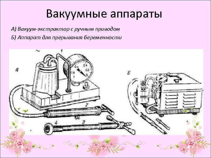 Вакуумные аппараты А) Вакуум-экстрактор с ручным приводом Б) Аппарат для прерывания беременности 