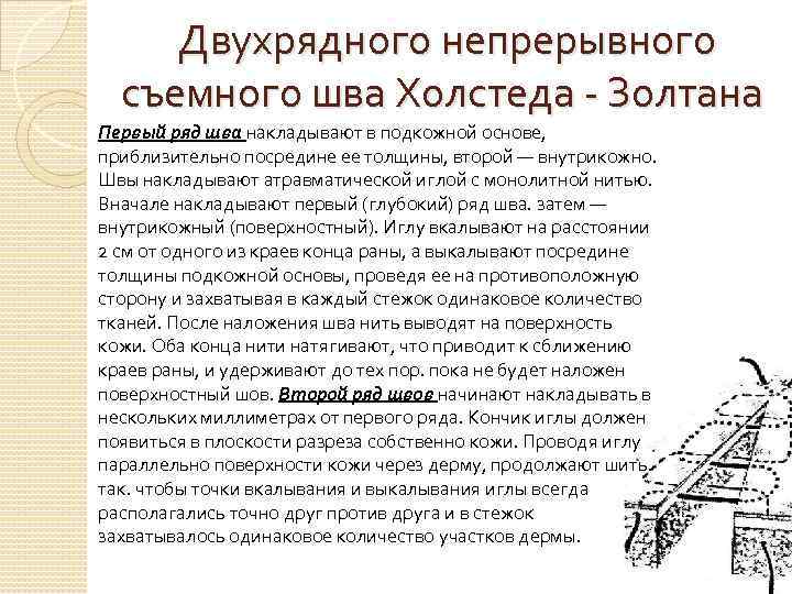 Двухрядного непрерывного съемного шва Холстеда - Золтана Первый ряд шва накладывают в подкожной основе,
