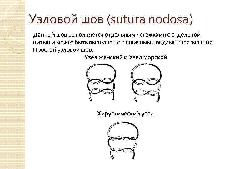 Узловой шов (sutura nodosa) Данный шов выполняется отдельными стежками с отдельной нитью и может