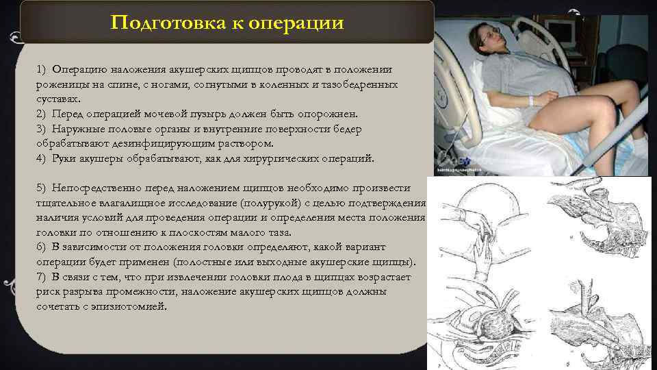 Акушерские операции презентация