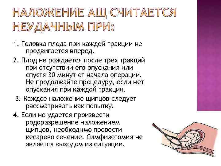 1. Головка плода при каждой тракции не продвигается вперед. 2. Плод не рождается после