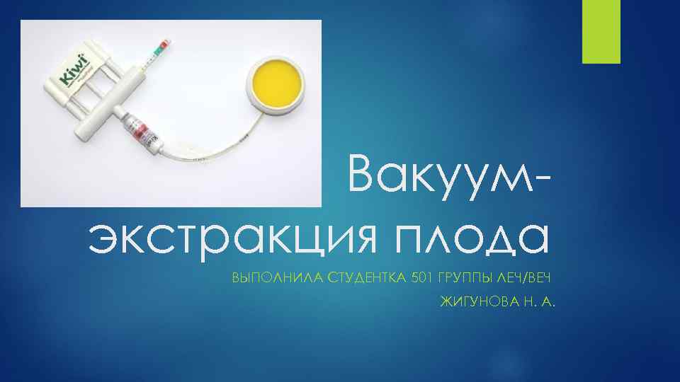 Вакуумэкстракция плода ВЫПОЛНИЛА СТУДЕНТКА 501 ГРУППЫ ЛЕЧ/ВЕЧ ЖИГУНОВА Н. А. 