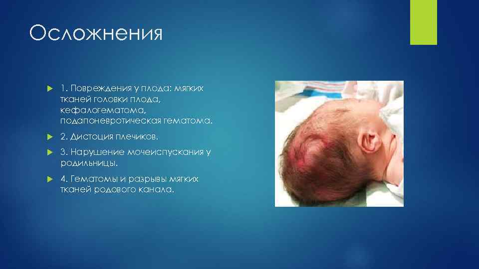 Осложнения 1. Повреждения у плода: мягких тканей головки плода, кефалогематома, подапоневротическая гематома. 2. Дистоция