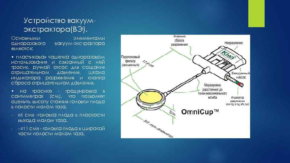 Устройство вакуумэкстрактора(ВЭ). Основными одноразового являются: элементами вакуум-экстрактора • пластиковая чашечка одноразовом использования и связанный
