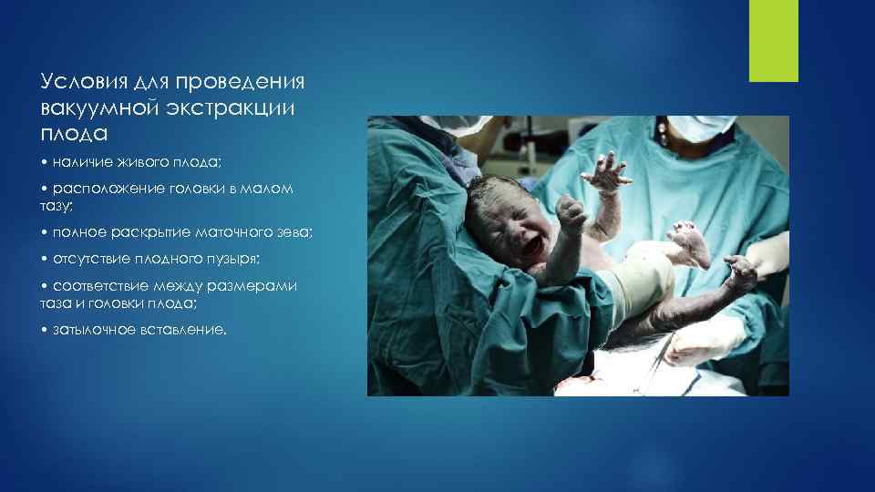 Условия для проведения вакуумной экстракции плода • наличие живого плода; • расположение головки в