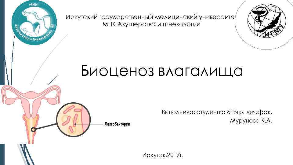 Иркутский государственный медицинский университет МНК Акушерства и гинекологии Биоценоз влагалища Выполнила: студентка 618 гр.