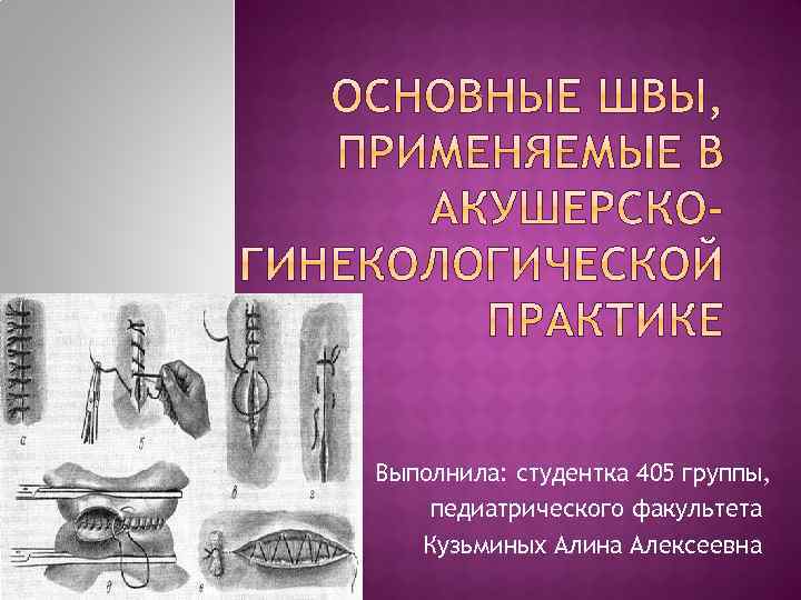 Выполнила: студентка 405 группы, педиатрического факультета Кузьминых Алина Алексеевна 