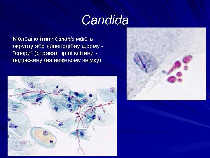 Candida Молоді клітини Candida мають округлу або яйцеподібну форму "спори" (справа), зрілі клітини -