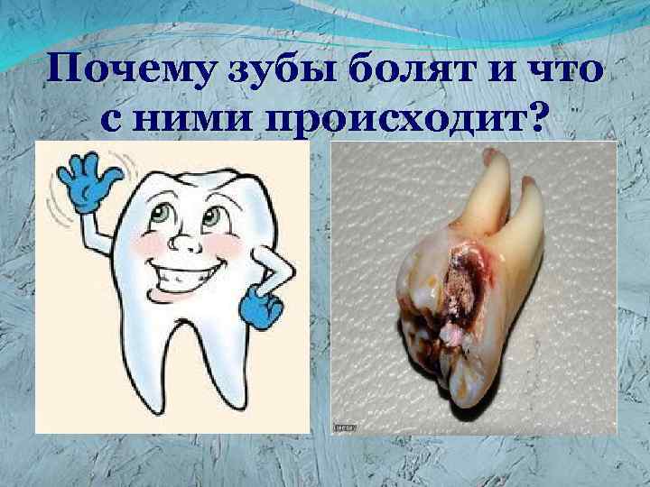 Почему зубы болят и что с ними происходит? 