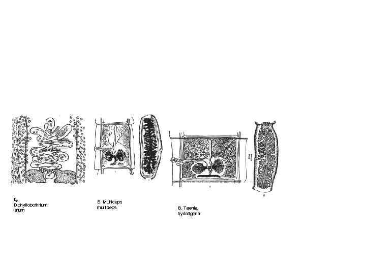 Д. Diphyllobothrium latum Б. Multiceps multiceps В. Taenia hydatigena 
