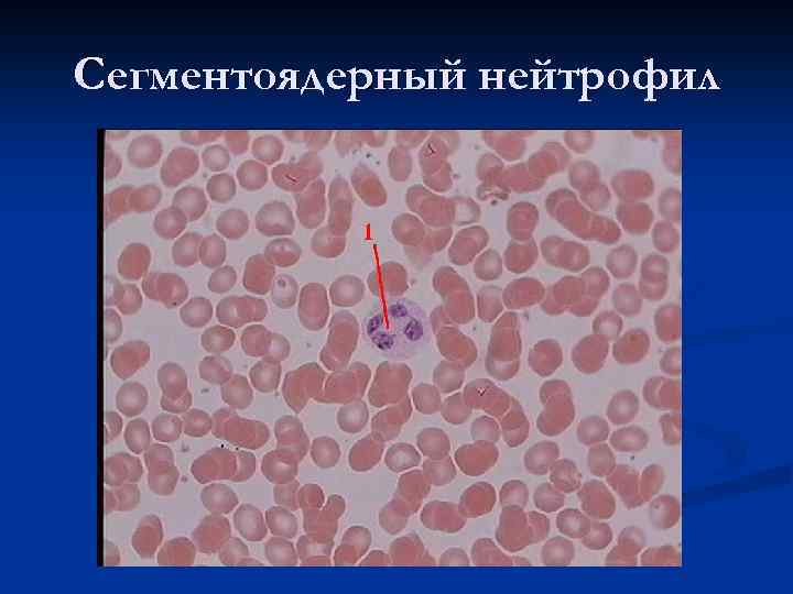 Сегментоядерный нейтрофил 