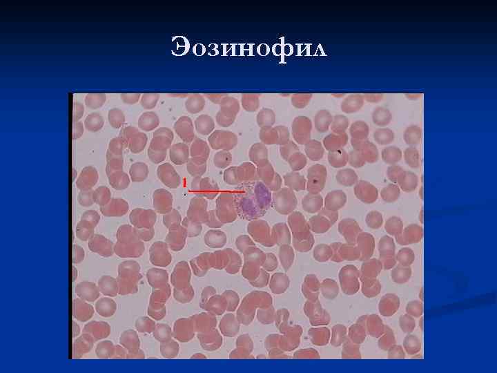 Эозинофил 