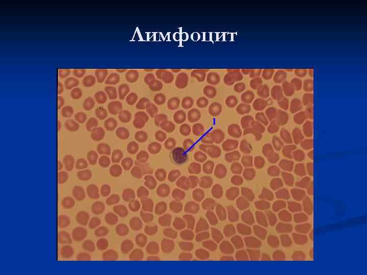 Лимфоцит 