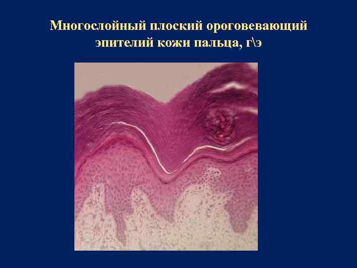 Многослойный плоский ороговевающий эпителий кожи пальца, гэ 