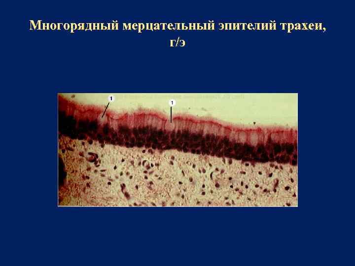 Многорядный мерцательный эпителий трахеи, г/э 