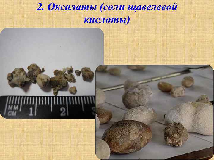 2. Оксалаты (соли щавелевой кислоты) 