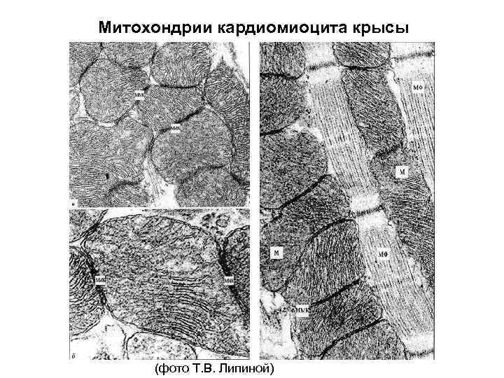 Митохондрии кардиомиоцита крысы (фото Т. В. Липиной) 