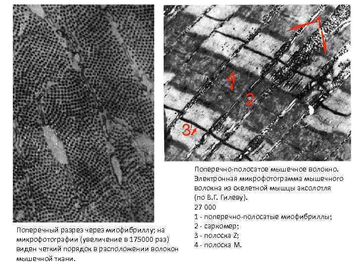 Поперечный разрез через миофибриллу; на микрофотографии (увеличение в 175000 раз) виден четкий порядок в