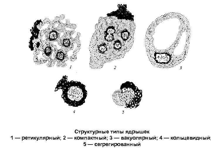 Структурные типы ядрышек 1 — ретикулярный; 2 — компактный; 3 — вакуолярный; 4 —