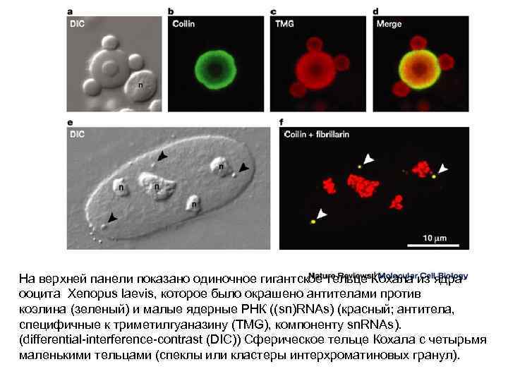 На верхней панели показано одиночное гигантское тельце Кохала из ядра ооцита Xenopus laevis, которое