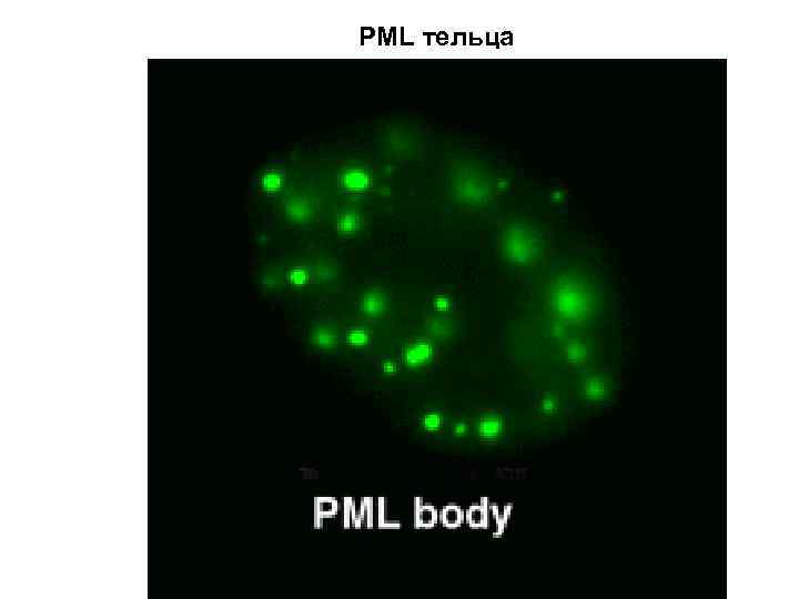 PML тельца 
