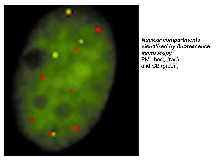 Nuclear compartments visualized by fluorescence microscopy PML body (red) and CB (green) 