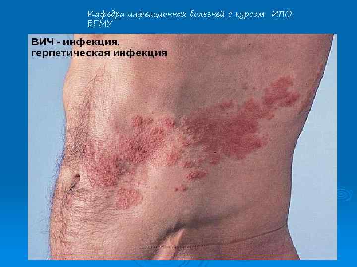 Кафедра инфекционных болезней с курсом ИПО БГМУ 