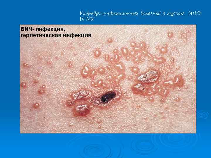 Кафедра инфекционных болезней с курсом ИПО БГМУ 