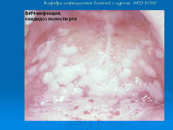 Кафедра инфекционных болезней с курсом ИПО БГМУ 