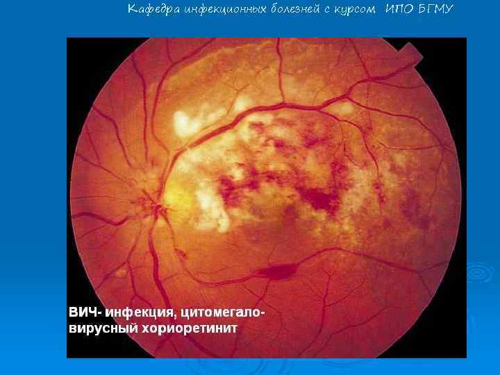 Кафедра инфекционных болезней с курсом ИПО БГМУ 