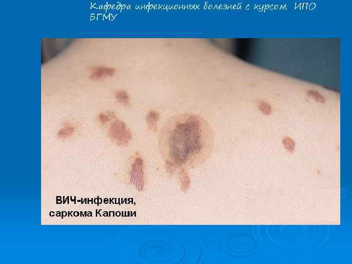 Кафедра инфекционных болезней с курсом ИПО БГМУ 