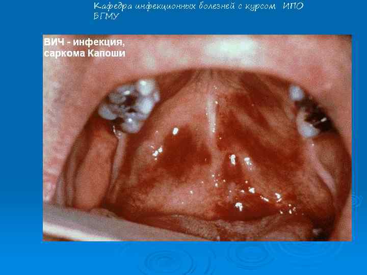 Кафедра инфекционных болезней с курсом ИПО БГМУ 