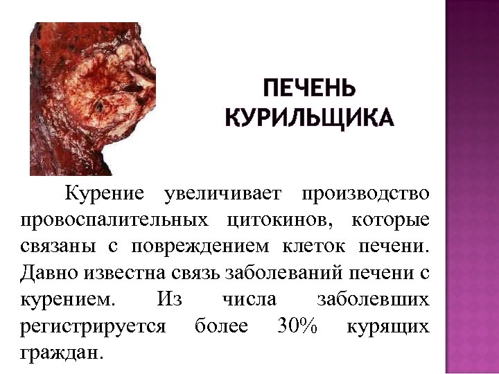 ПЕЧЕНЬ КУРИЛЬЩИКА Курение увеличивает производство провоспалительных цитокинов, которые связаны с повреждением клеток печени. Давно