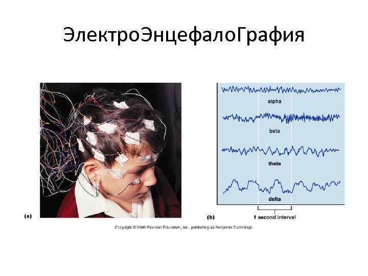 Электро. Энцефало. Графия 