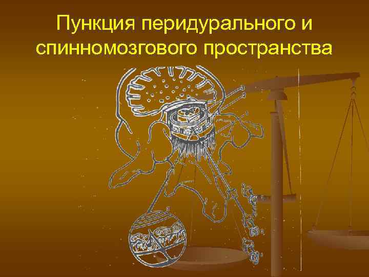 Пункция перидурального и спинномозгового пространства 