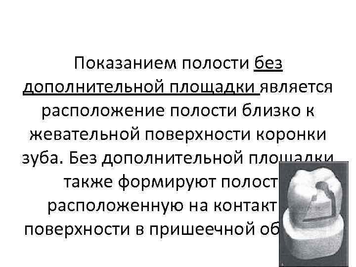 Без полости. Доп площадка кариозной полости. Препарирование с дополнительной площадкой. Препарирование зуба без дополнительной площадки. Препарирование полостей с дополнительными площадками.