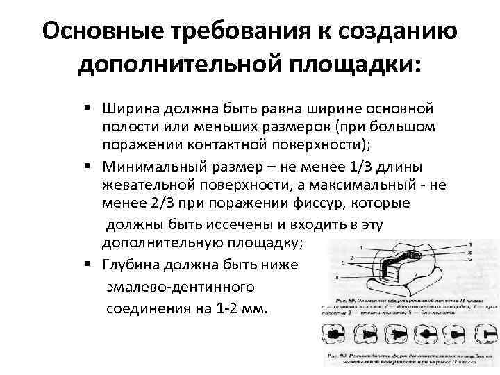 Дополнительные площадки кариозной полости. Требования к дополнительной площадке при препарировании. Требования предъявляемые к сформированной кариозной полости. Кариозные полости требования к дополнительной площадке. Основные требования к созданию дополнительной площадки.